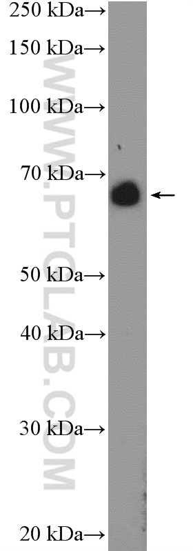 WB analysis of mouse thymus using 24581-1-AP