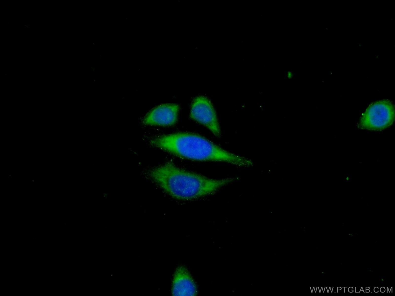 IF Staining of PC-3 using 24027-1-AP