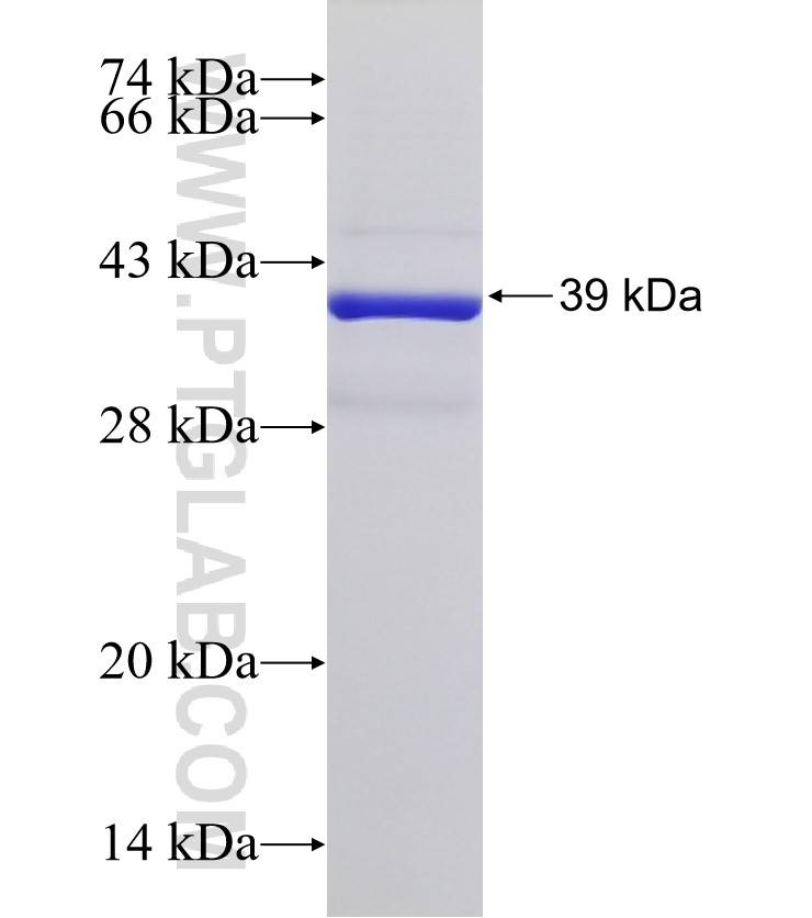 ANKRD42 fusion protein Ag32829 SDS-PAGE ANKRD42 fusion protein Ag32829 SDS-PAGE