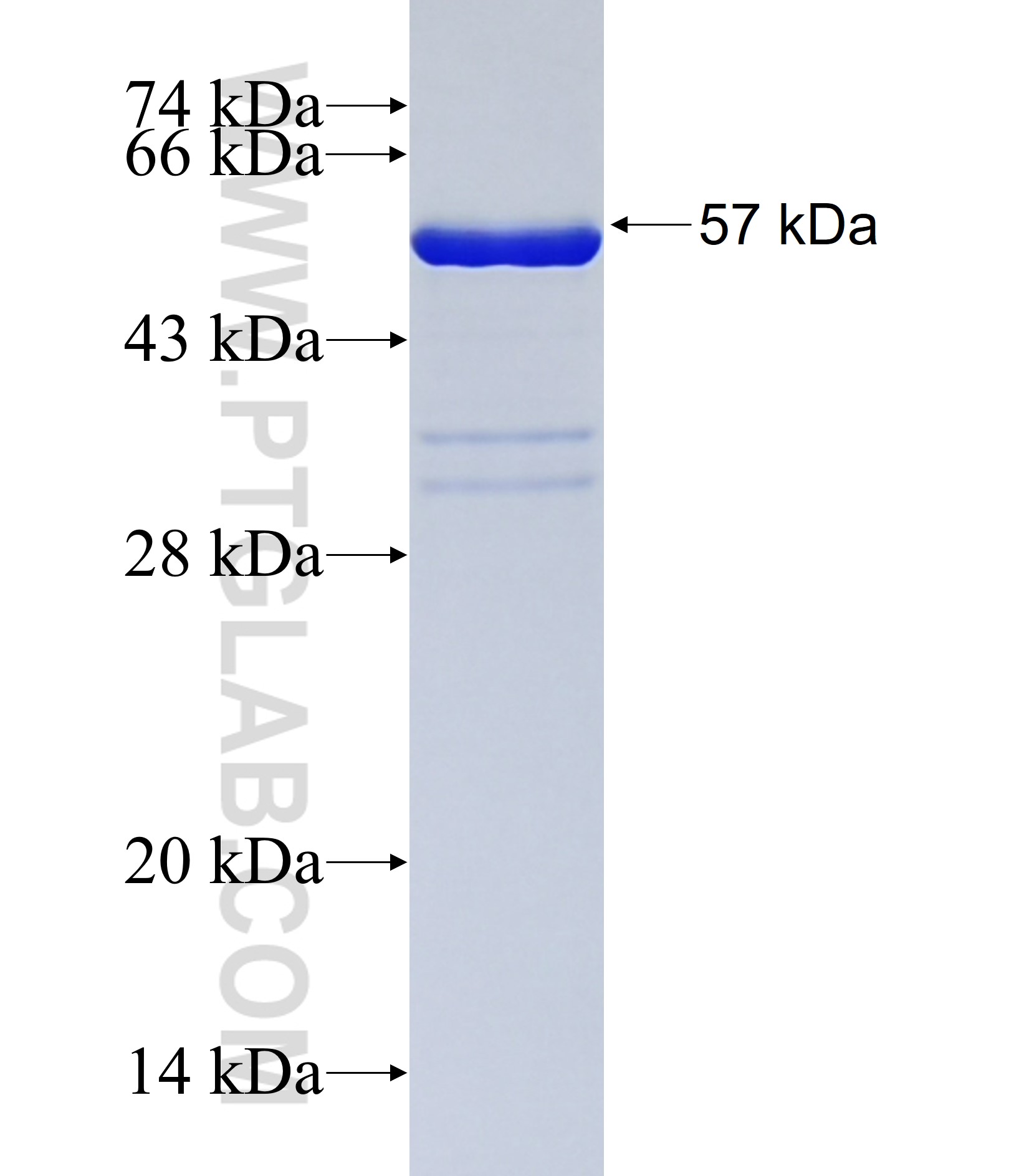 ANKRD45 fusion protein Ag38065 SDS-PAGE ANKRD45 fusion protein Ag38065 SDS-PAGE