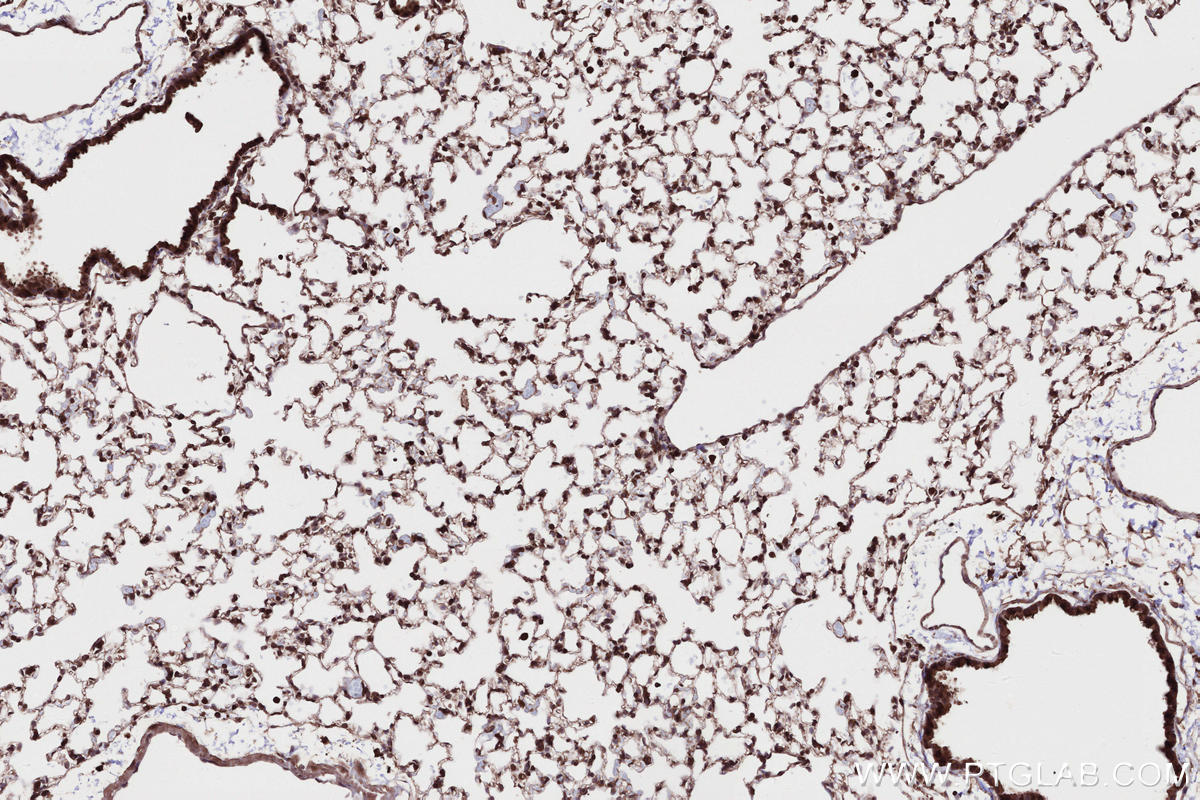 IHC staining of mouse lung using 24283-1-AP