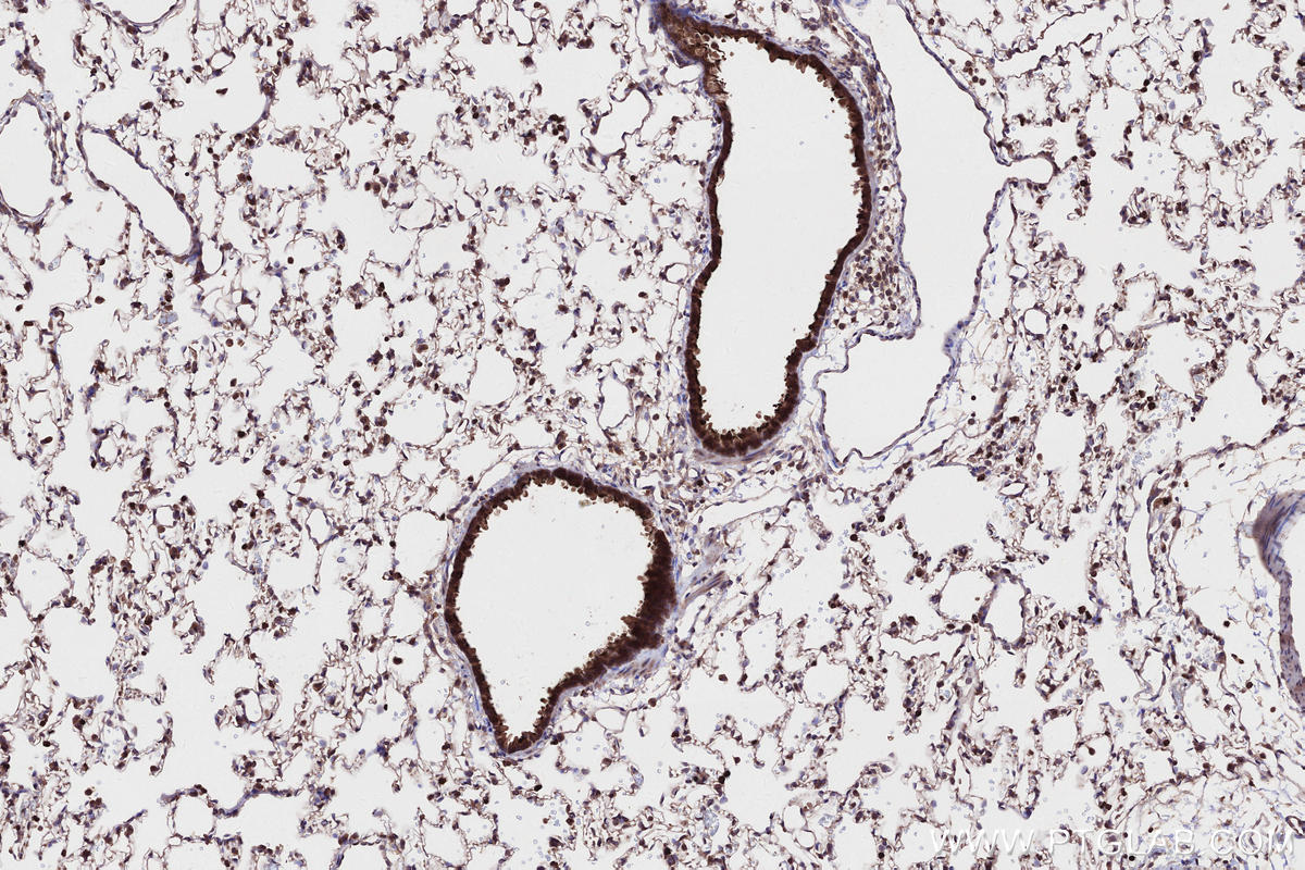 IHC staining of rat lung using 24283-1-AP