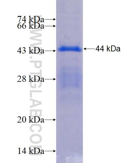 ANKRD53 fusion protein Ag15443 SDS-PAGE