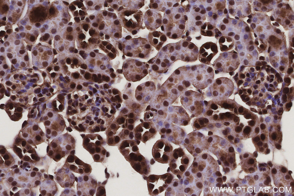 IHC staining of mouse kidney using 25738-1-AP IHC staining of mouse kidney using 25738-1-AP