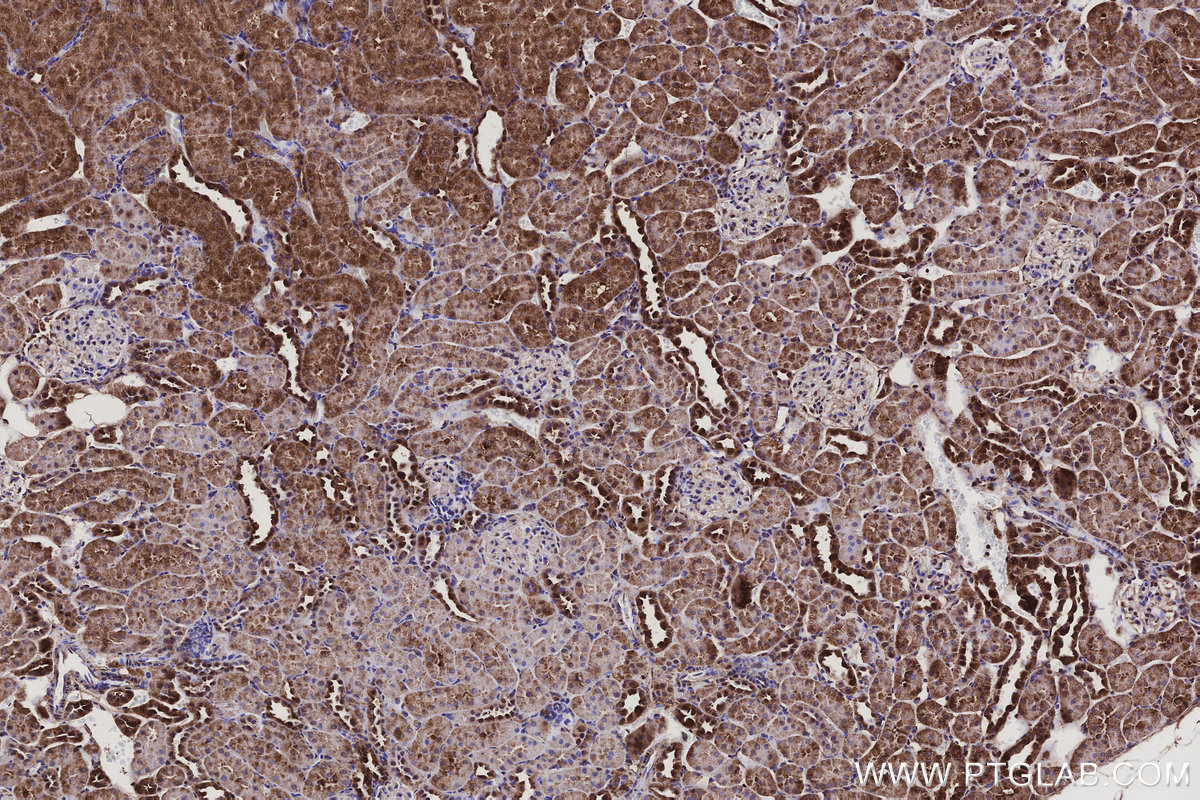 IHC staining of rat kidney using 25738-1-AP IHC staining of rat kidney using 25738-1-AP
