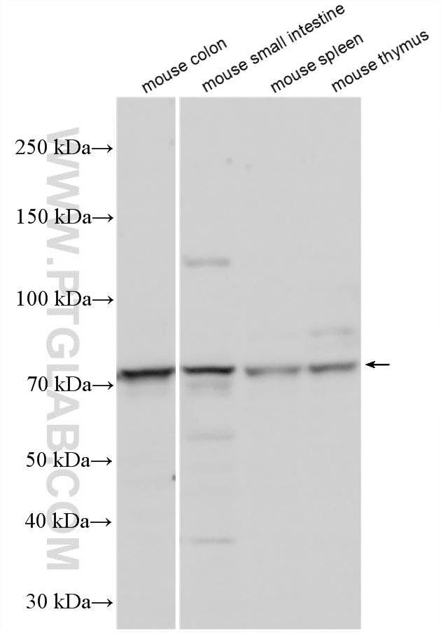 Various lysates were subjected to SDS PAGE followed by western blot with 24203-1-AP (ANKRD55 antibody) at dilution of 1:600 incubated at room temperature for 1.5 hours. WB analysis using 24203-1-AP