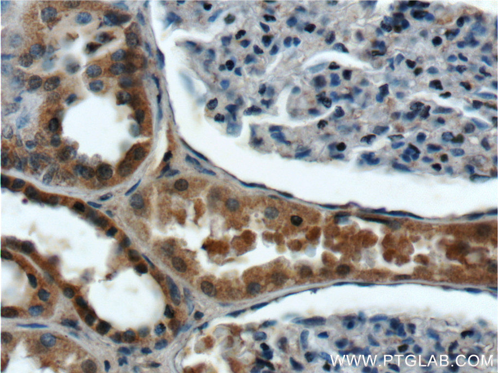 IHC staining of human kidney using 24333-1-AP