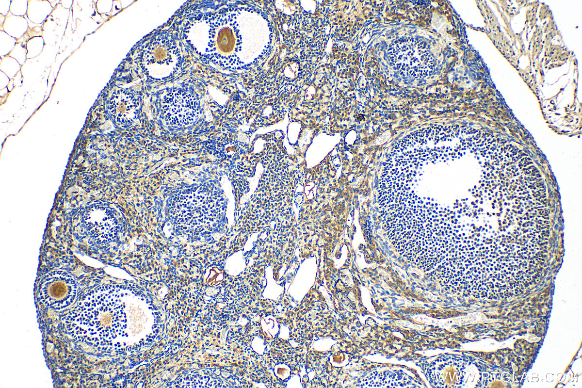 IHC staining of mouse ovary using 24333-1-AP