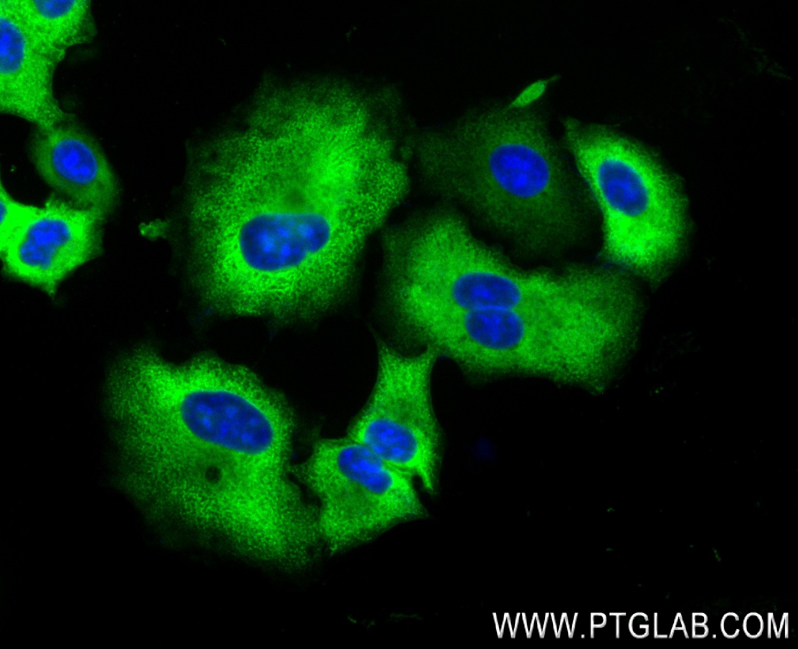 IF Staining of A549 using 84210-4-RR (same clone as 84210-4-PBS)