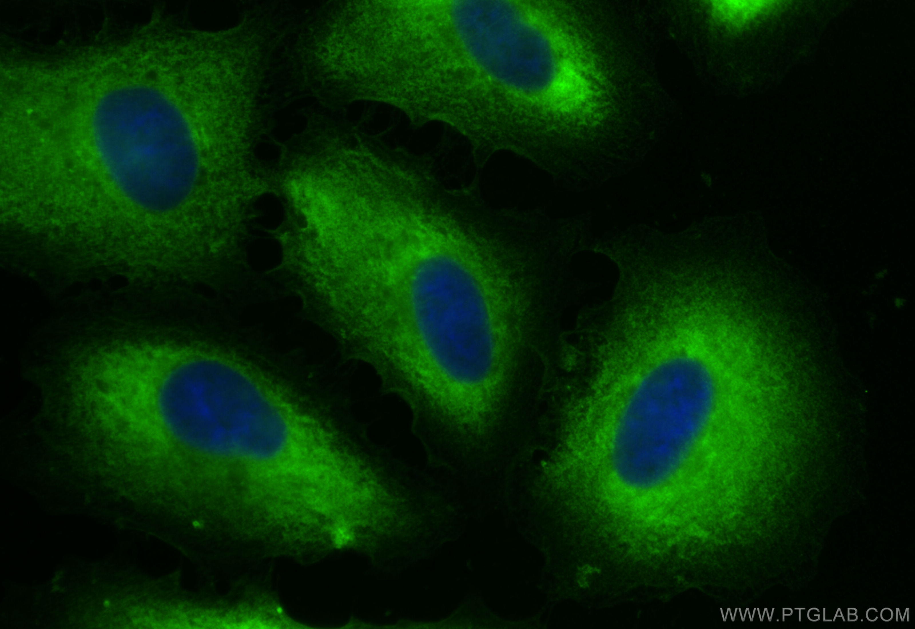 IF Staining of A549 using CL488-84210-4