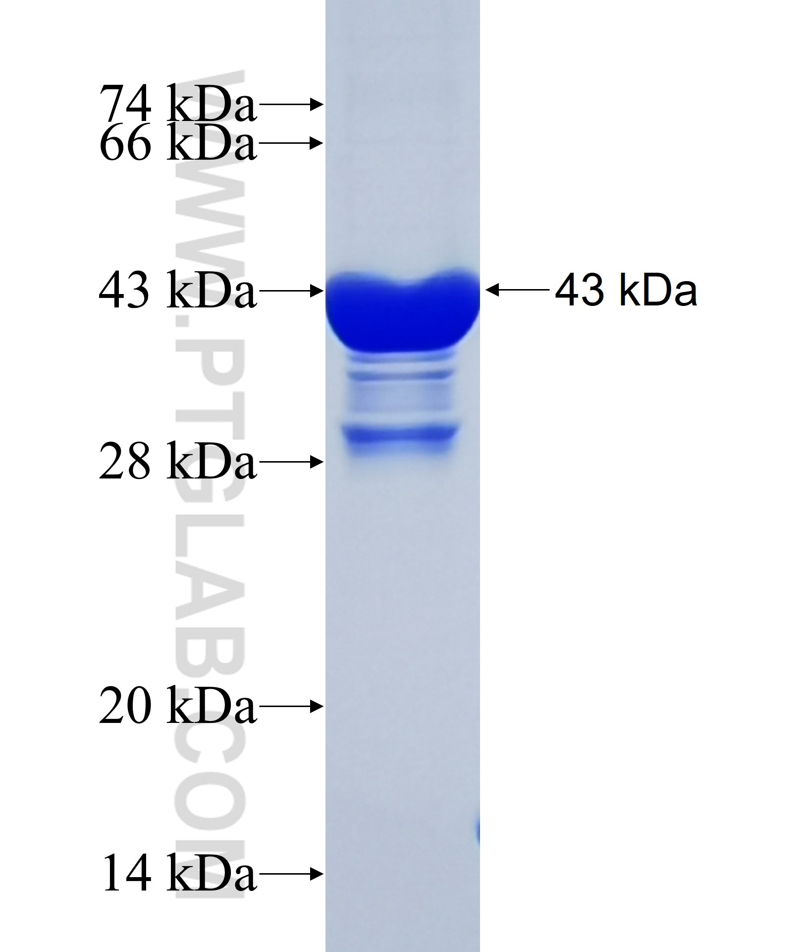 ANKRD6 fusion protein Ag34624 SDS-PAGE ANKRD6 fusion protein Ag34624 SDS-PAGE