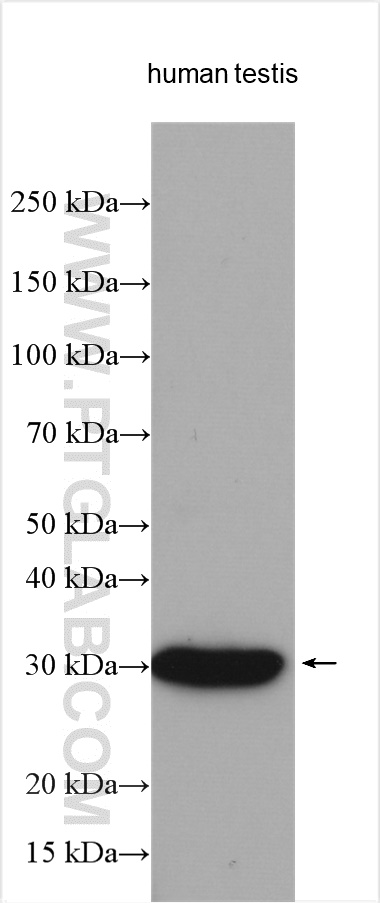 WB analysis using 21023-1-AP