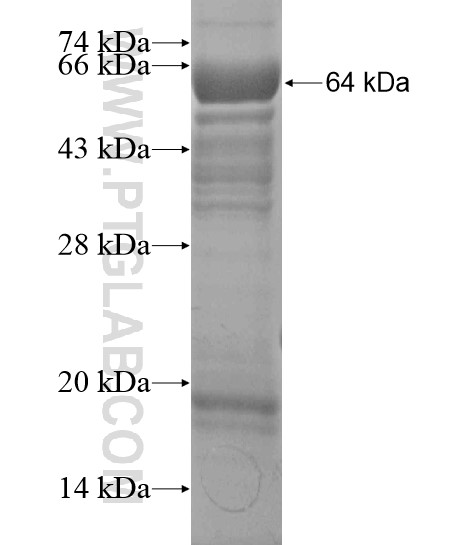 ANKS1A fusion protein Ag20059 SDS-PAGE ANKS1A fusion protein Ag20059 SDS-PAGE