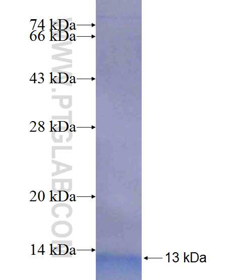 ANKS1B fusion protein Ag20496 SDS-PAGE