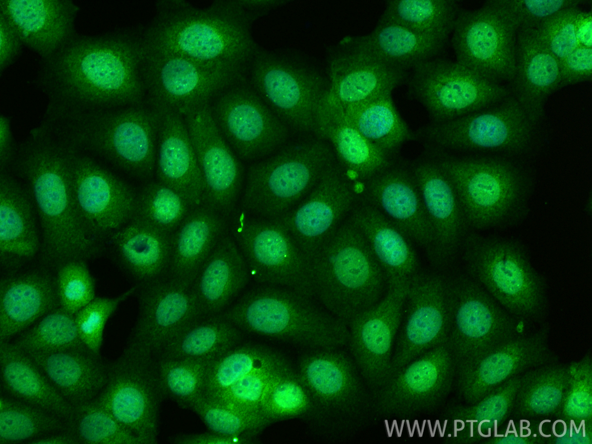 IF Staining of MCF-7 using 24058-1-AP