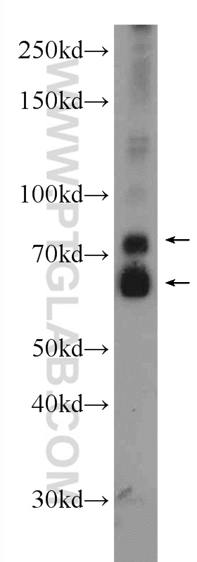 WB analysis of mouse liver using 24058-1-AP