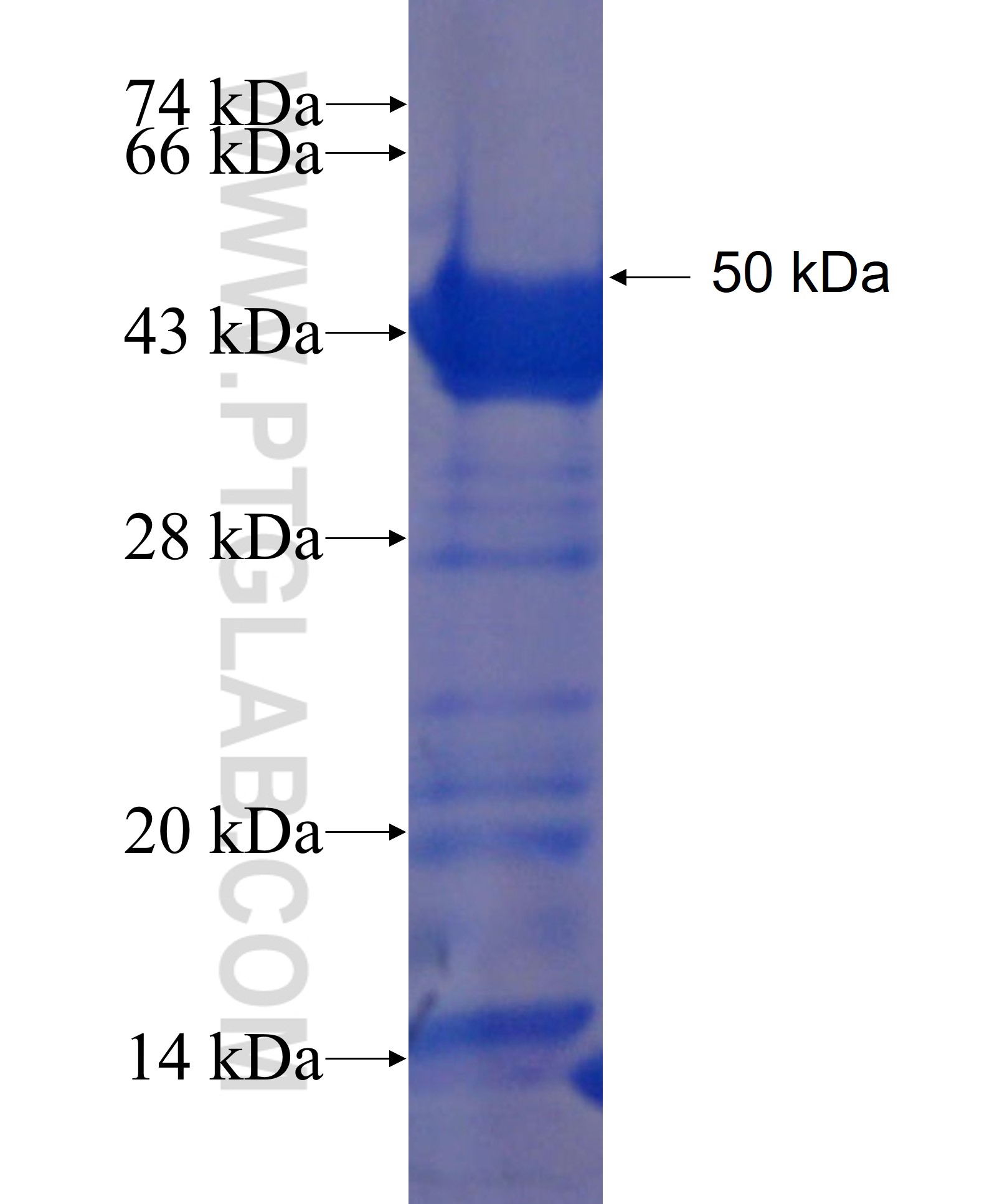 ANKS6 fusion protein Ag22771 SDS-PAGE