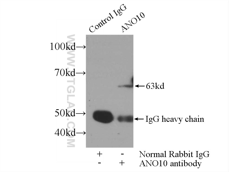 IP experiment of mouse brain using 21901-1-AP