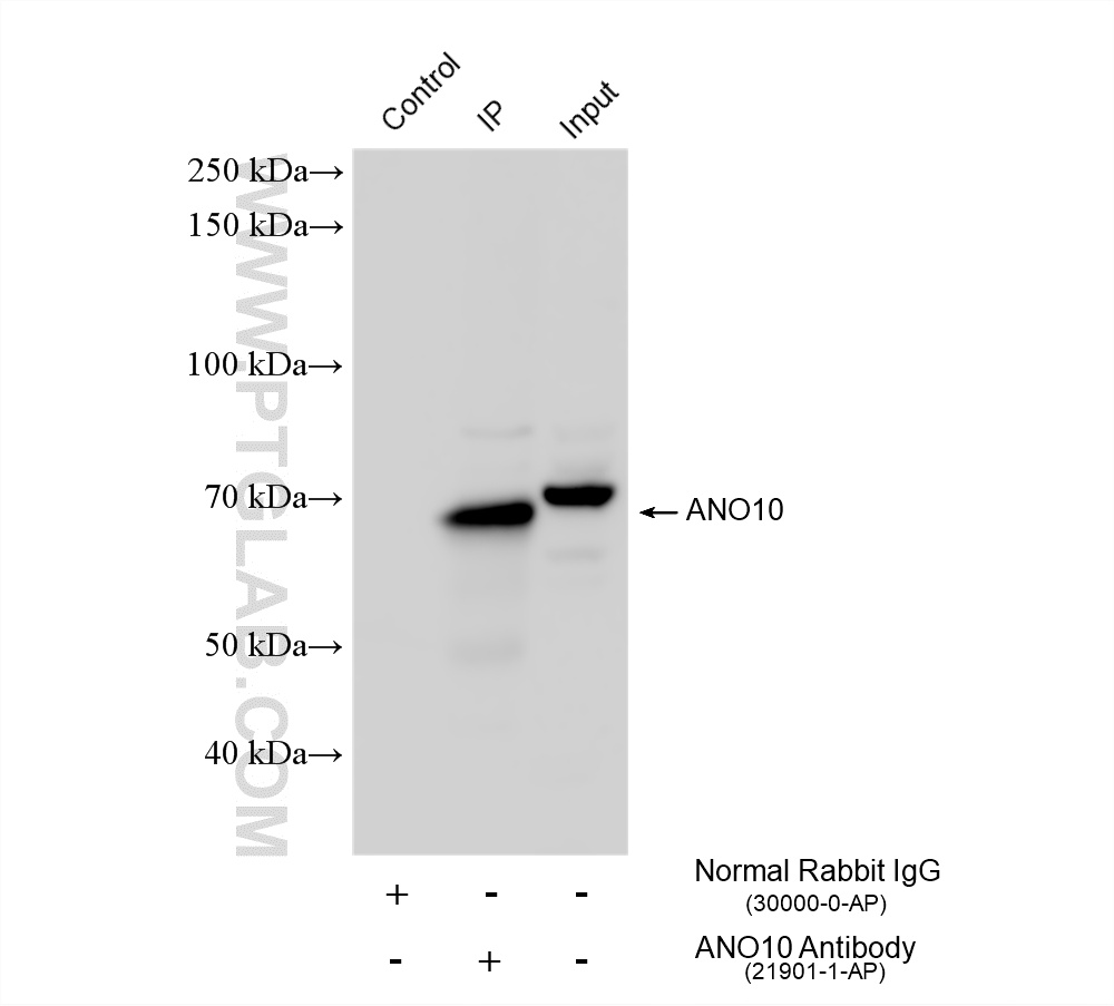 IP result of anti-ANO10 (IP:21901-1-AP, 4ug; Detection:21901-1-AP 1:2000) with mouse brain tissue lysate 1960 ug. IP experiment of mouse brain using 21901-1-AP