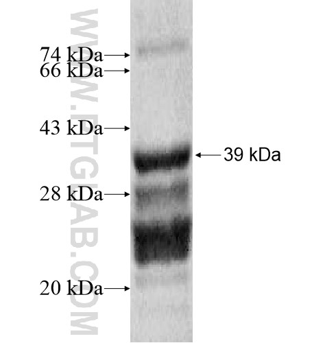 ANO10 fusion protein Ag13935 SDS-PAGE ANO10 fusion protein Ag13935 SDS-PAGE
