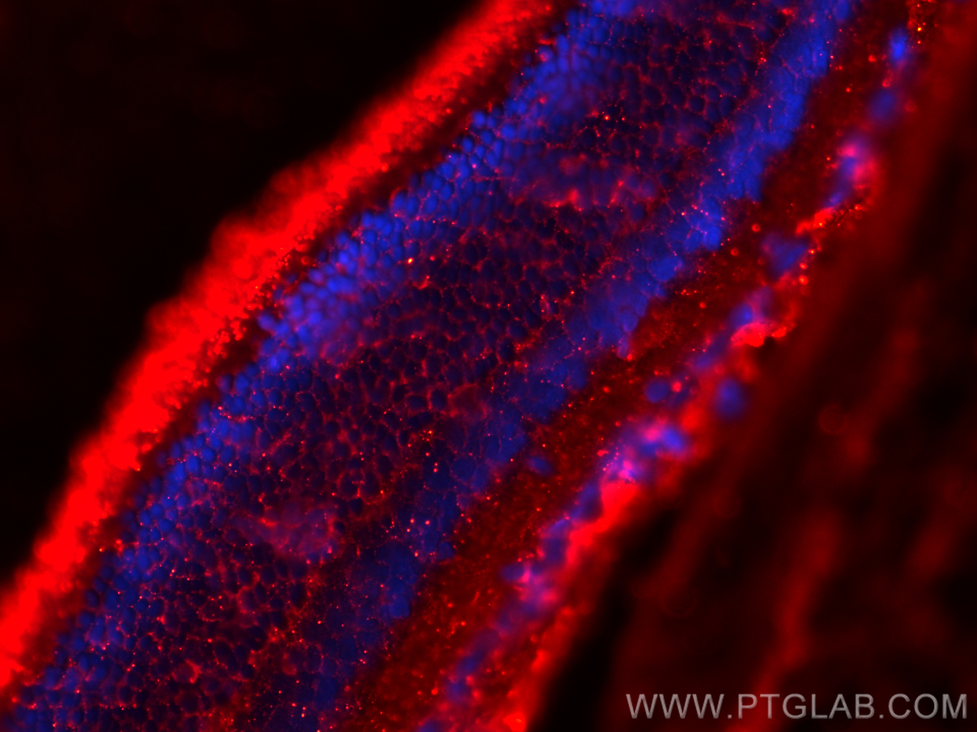 IF Staining of rat eye using 20647-1-AP