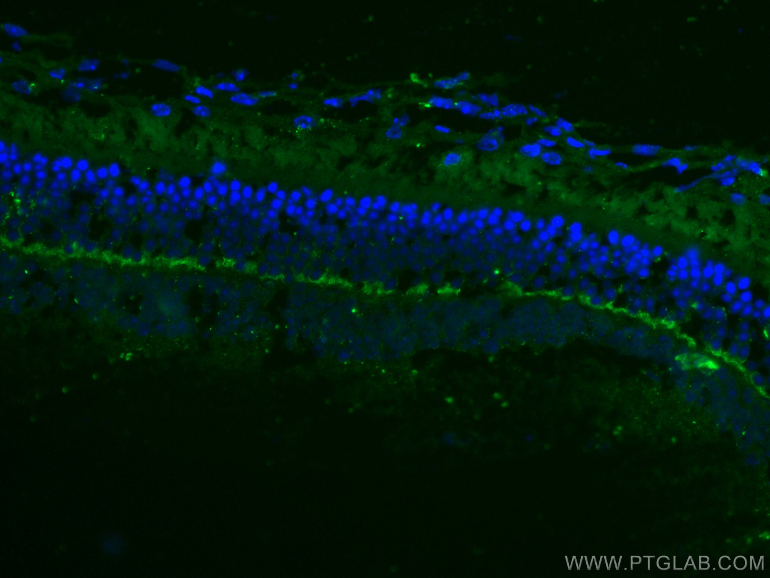 IF Staining of mouse eye using 67638-1-Ig