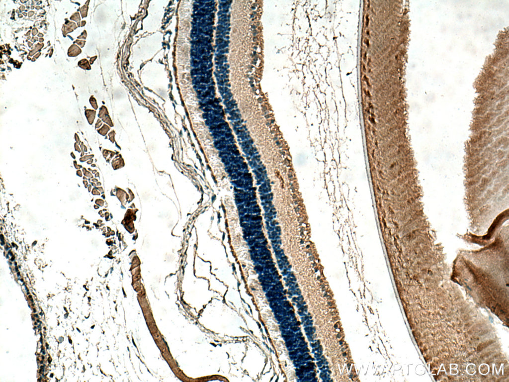 IHC staining of mouse eye using 67638-1-Ig