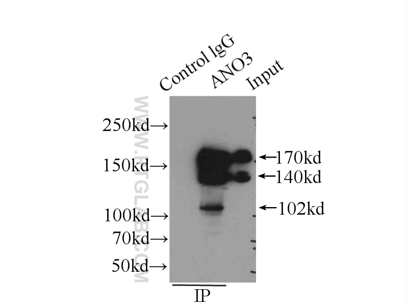 IP experiment of mouse testis using 19489-1-AP