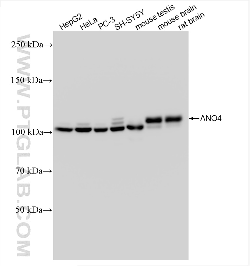 WB analysis using 82970-1-RR (same clone as 82970-1-PBS)