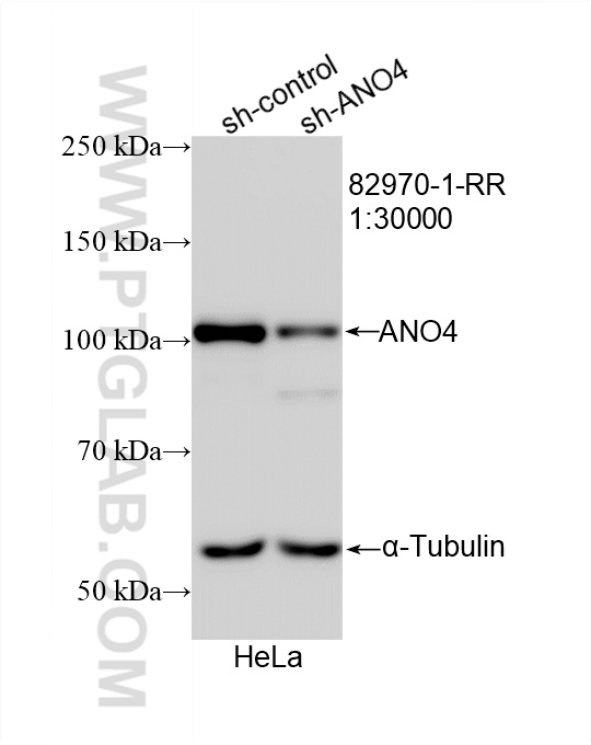 WB analysis of HeLa using 82970-1-RR (same clone as 82970-1-PBS)