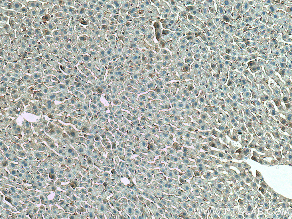 IHC staining of mouse liver using 20784-1-AP
