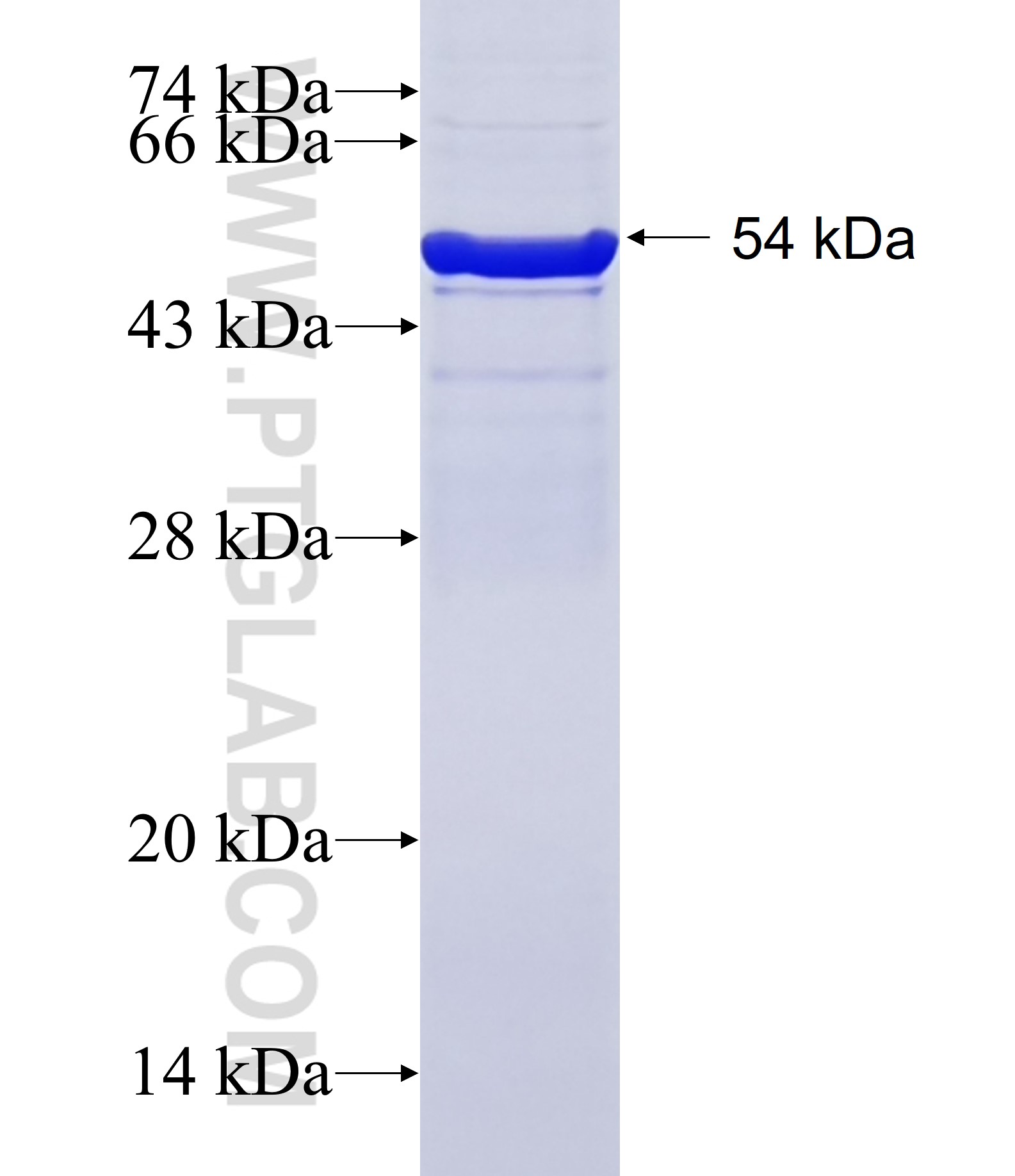 ANO9 fusion protein Ag27550 SDS-PAGE ANO9 fusion protein Ag27550 SDS-PAGE