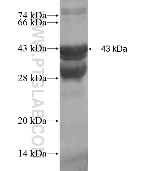 ANO9 fusion protein Ag18941 SDS-PAGE ANO9 fusion protein Ag18941 SDS-PAGE