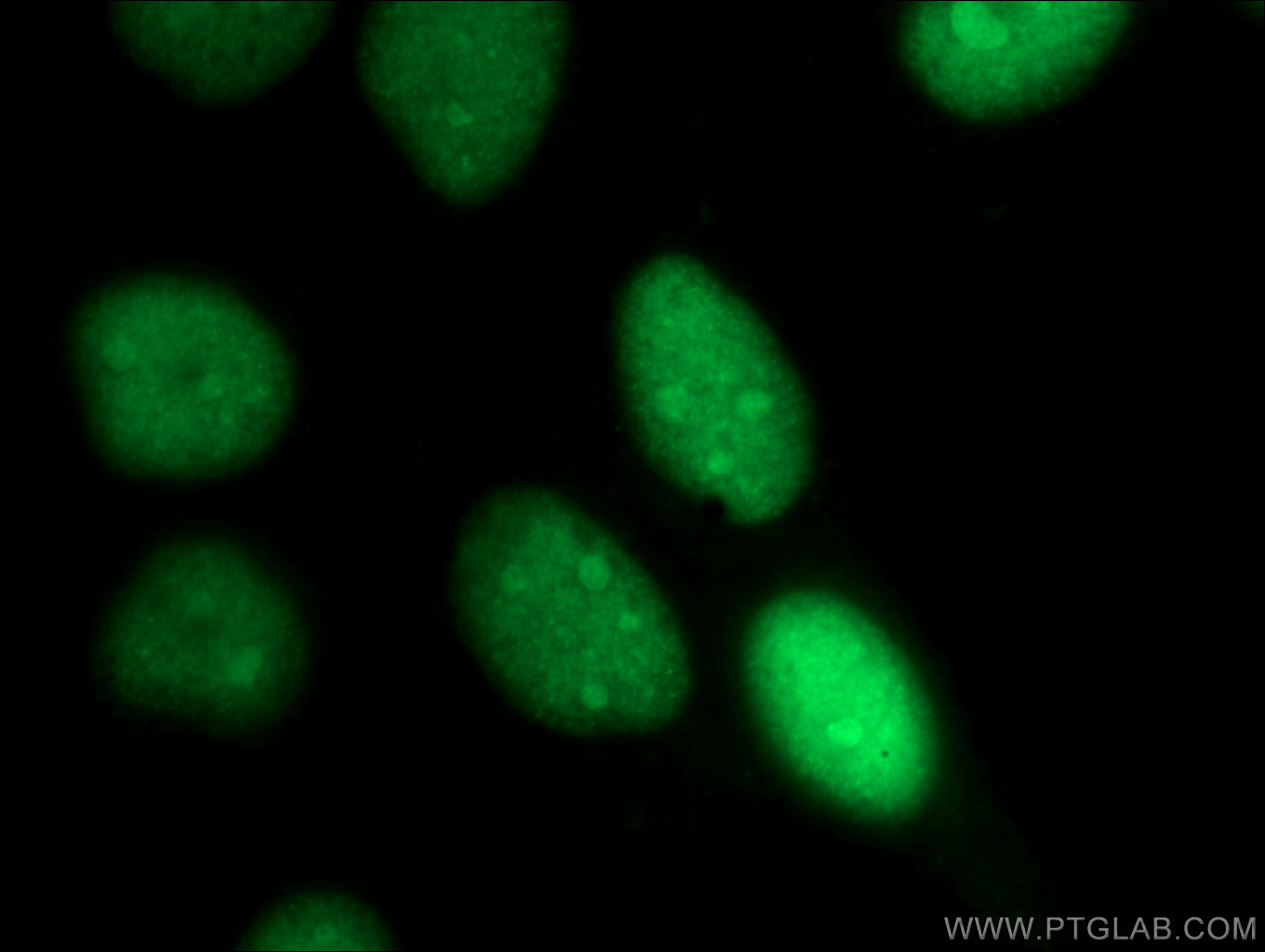 IF Staining of A431 using 15810-1-AP