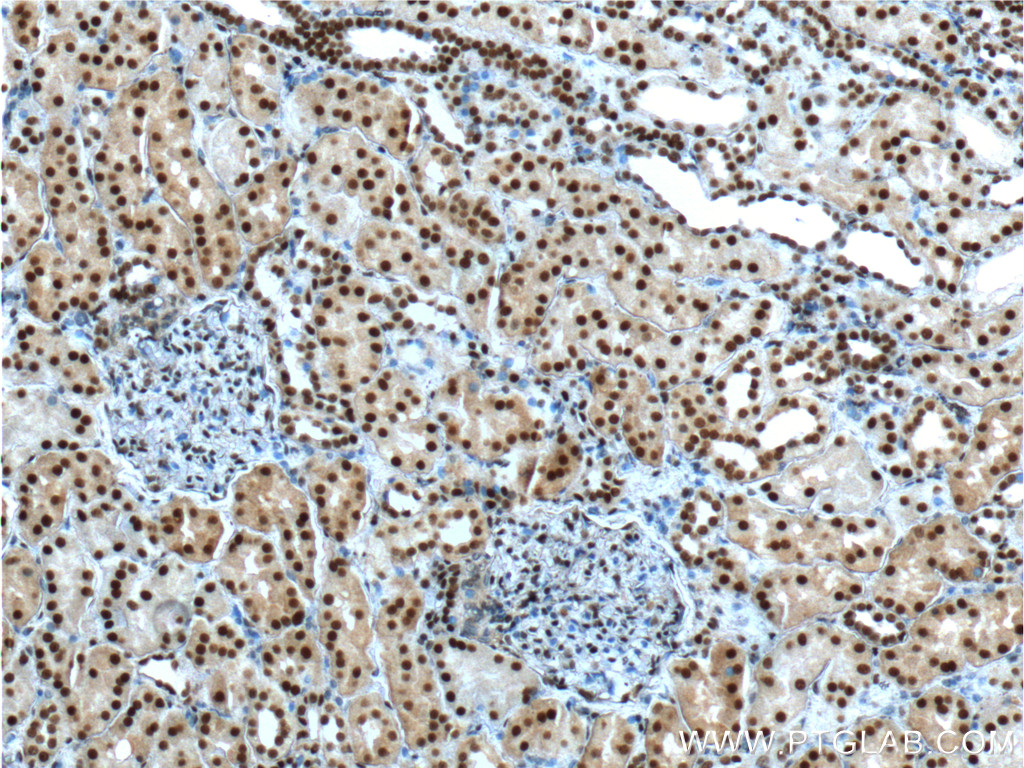 IHC staining of human kidney using 15810-1-AP