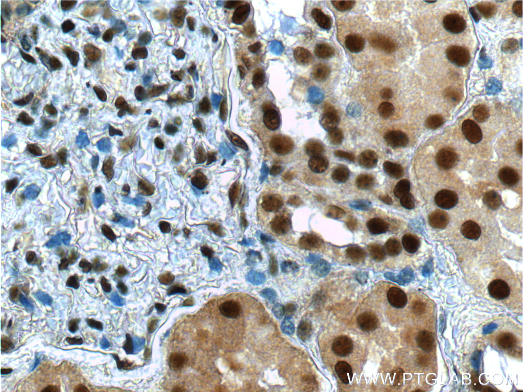 IHC staining of human kidney using 15810-1-AP