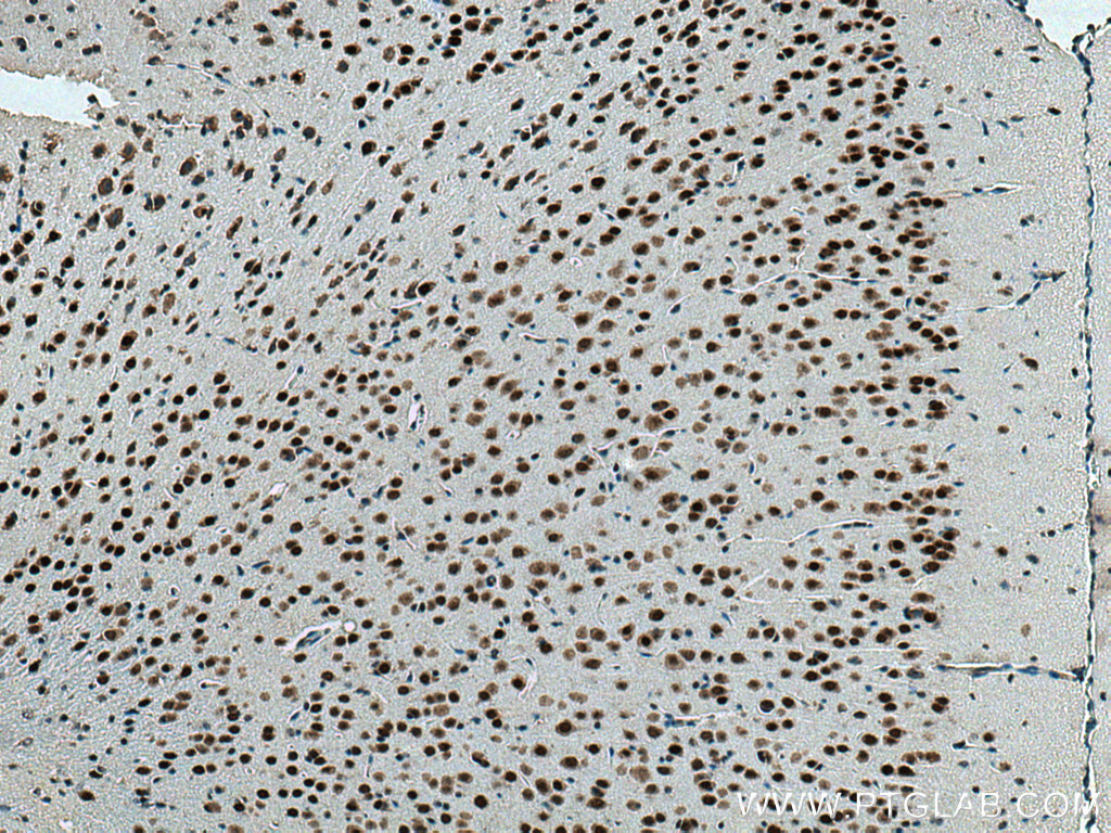 IHC staining of mouse brain using 67687-1-Ig