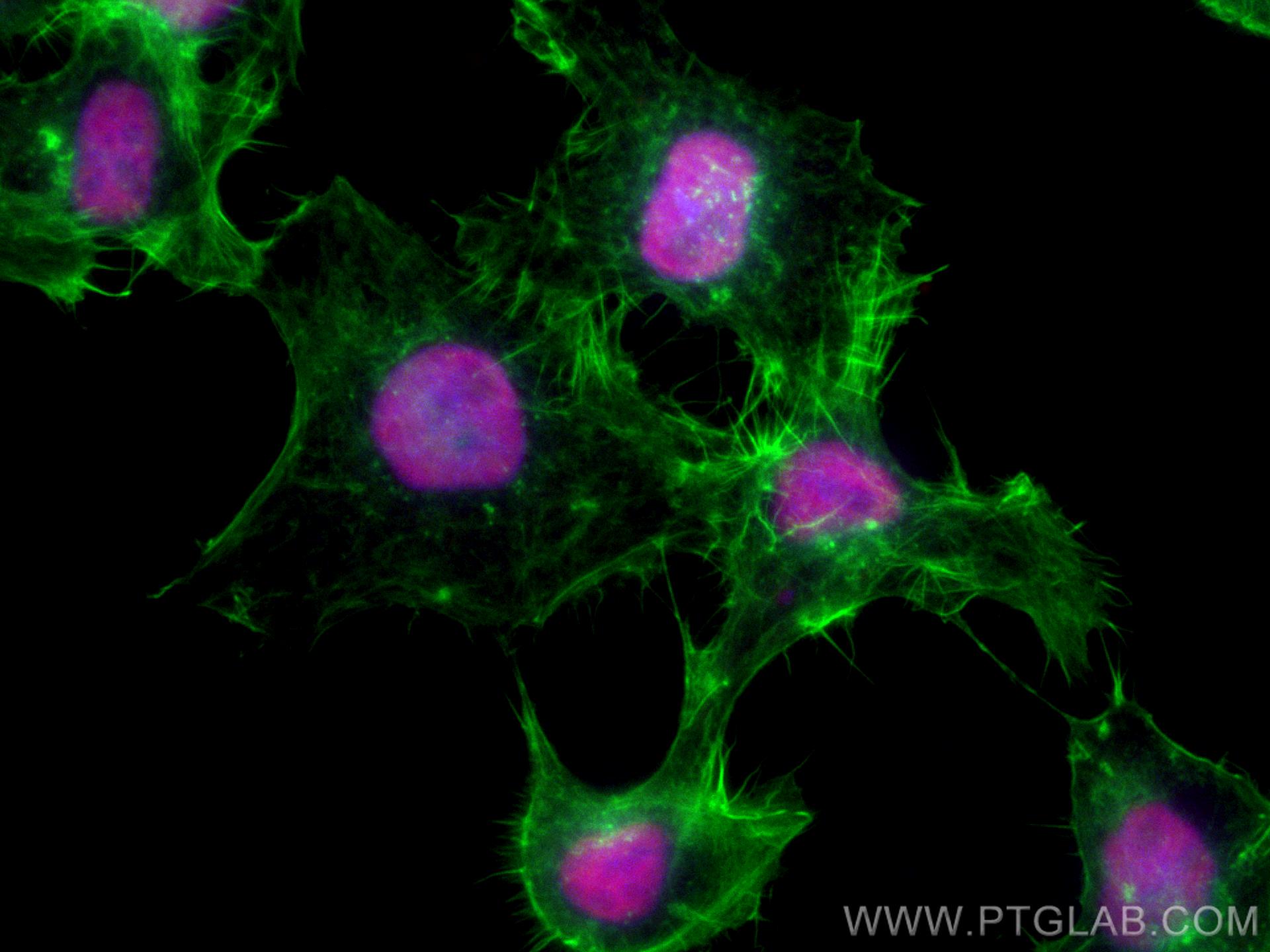 IF Staining of A431 using CL594-67687