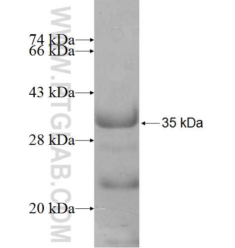 ANP32A fusion protein Ag8447 SDS-PAGE ANP32A fusion protein Ag8447 SDS-PAGE