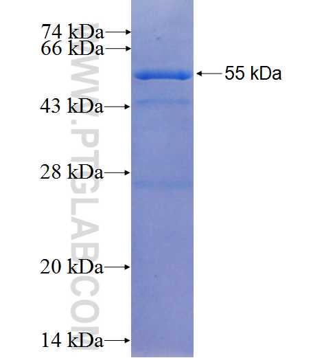 ANP32A fusion protein Ag8546 SDS-PAGE