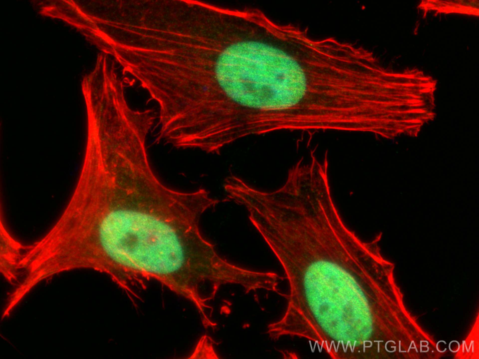 IF Staining of HeLa using 10843-1-AP