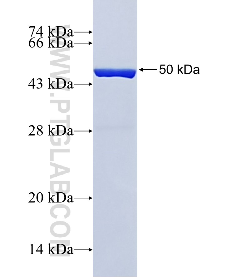 ANP32B fusion protein Ag1274 SDS-PAGE