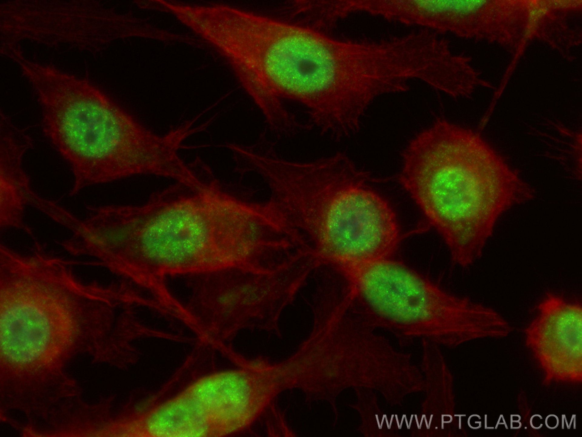 Immunofluorescent analysis of (-20°C Ethanol) fixed PC-3 cells using ANP32CP antibody (31298-1-AP) at dilution of 1:400 and CoraLite®488-Conjugated Goat Anti-Rabbit IgG(H+L) (<a class='green' href='/productredirect?CatalogNo=SA00013-2' target='_blank'>SA00013-2</a>), CL594-Phalloidin (red). IF Staining of PC-3 using 31298-1-AP