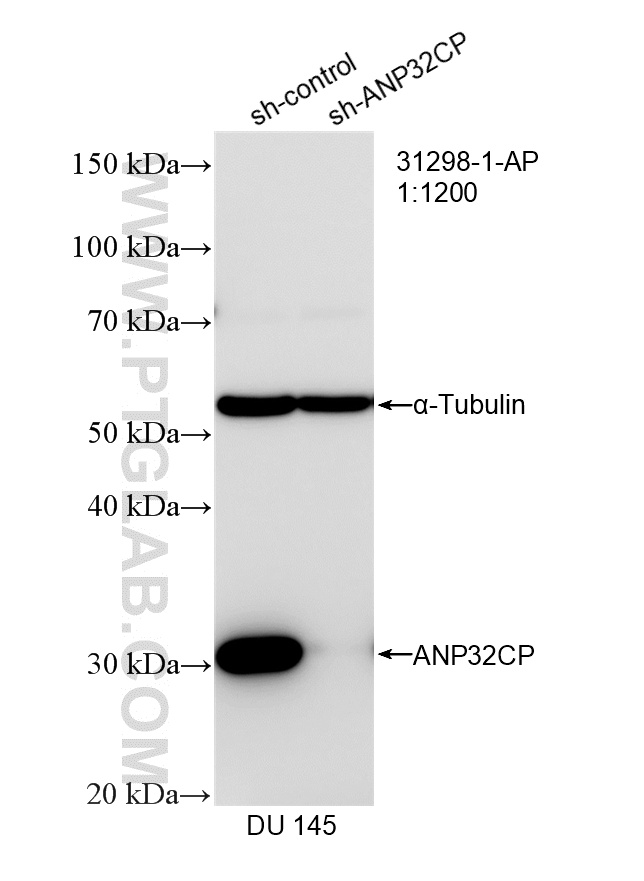 WB result of ANP32CP antibody (31298-1-AP; 1:1200; incubated at room temperature for 1.5 hours) with sh-Control and sh-ANP32CP transfected DU 145 cells. WB analysis of DU 145 using 31298-1-AP