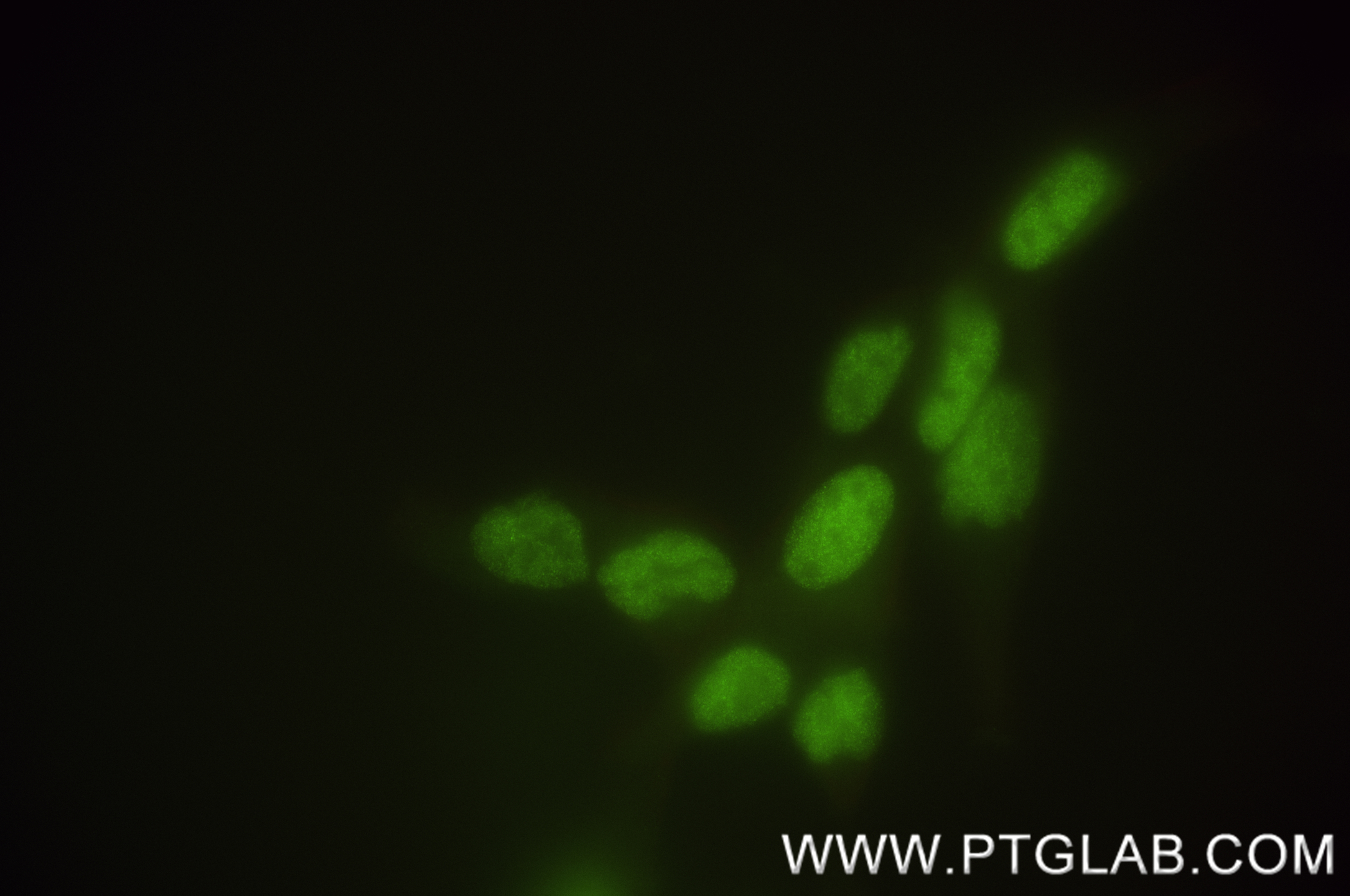 IF Staining of LNCaP using 84553-1-RR (same clone as 84553-1-PBS)