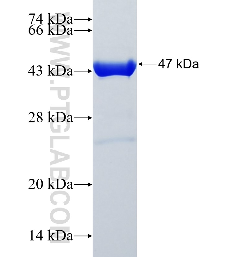 ANP32CP fusion protein Ag35293 SDS-PAGE
