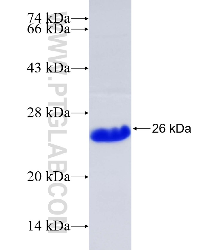 ANP32CP fusion protein Ag35339 SDS-PAGE ANP32CP fusion protein Ag35339 SDS-PAGE