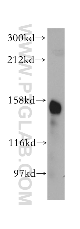 CD13 Polyclonal antibody