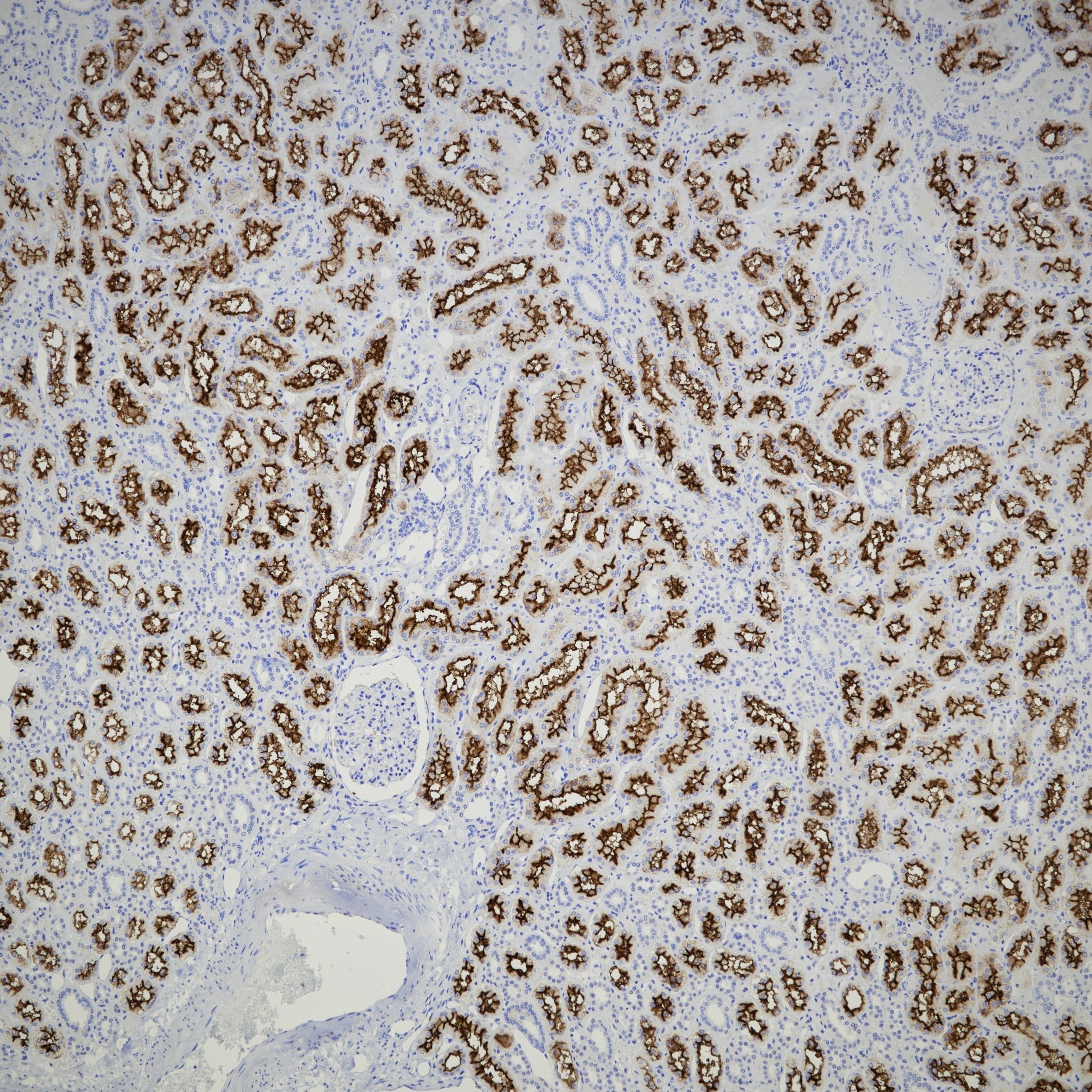 IHC staining of human kidney using 66211-1-Ig (same clone as 66211-1-PBS)