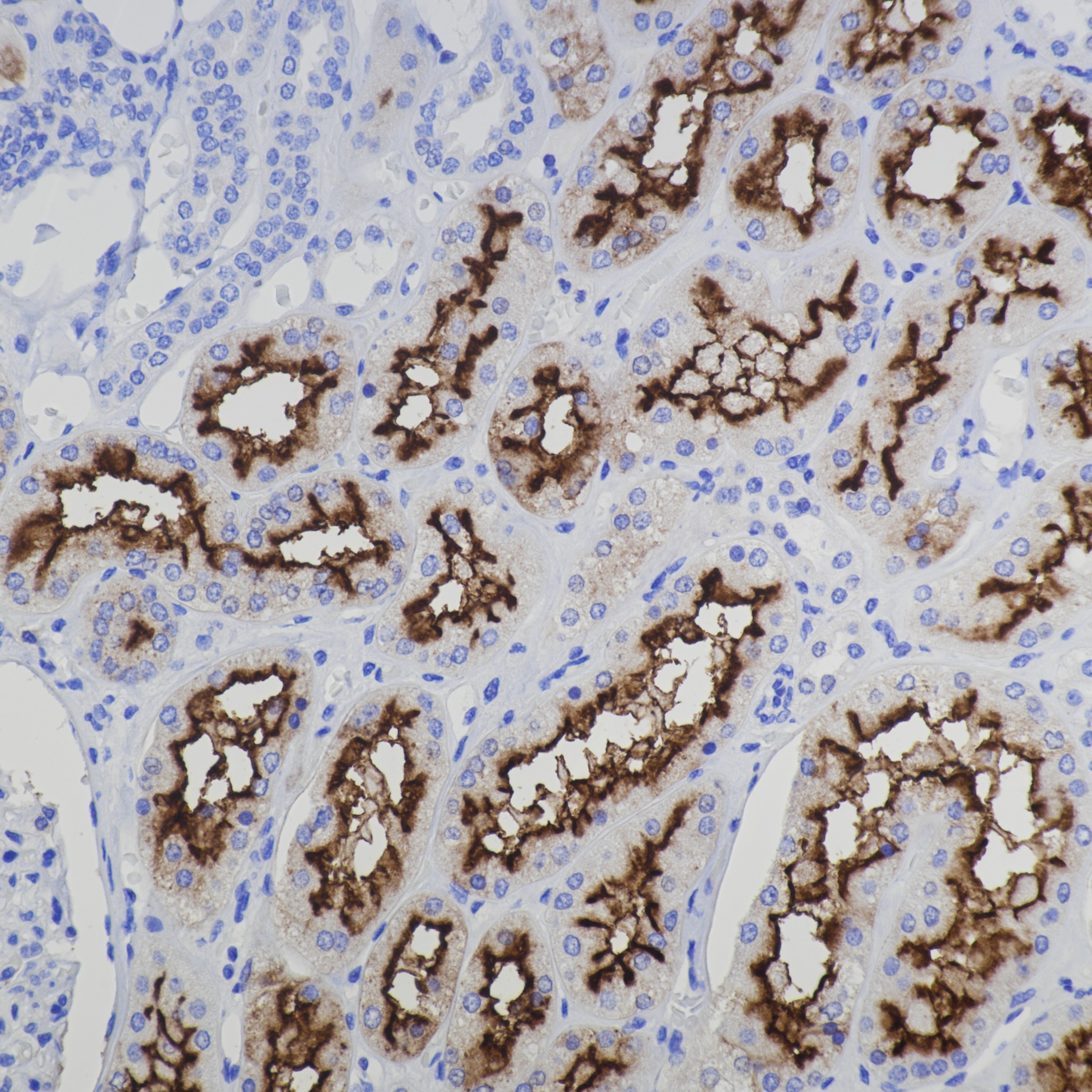 IHC staining of human kidney using 66211-1-Ig IHC staining of human kidney using 66211-1-Ig